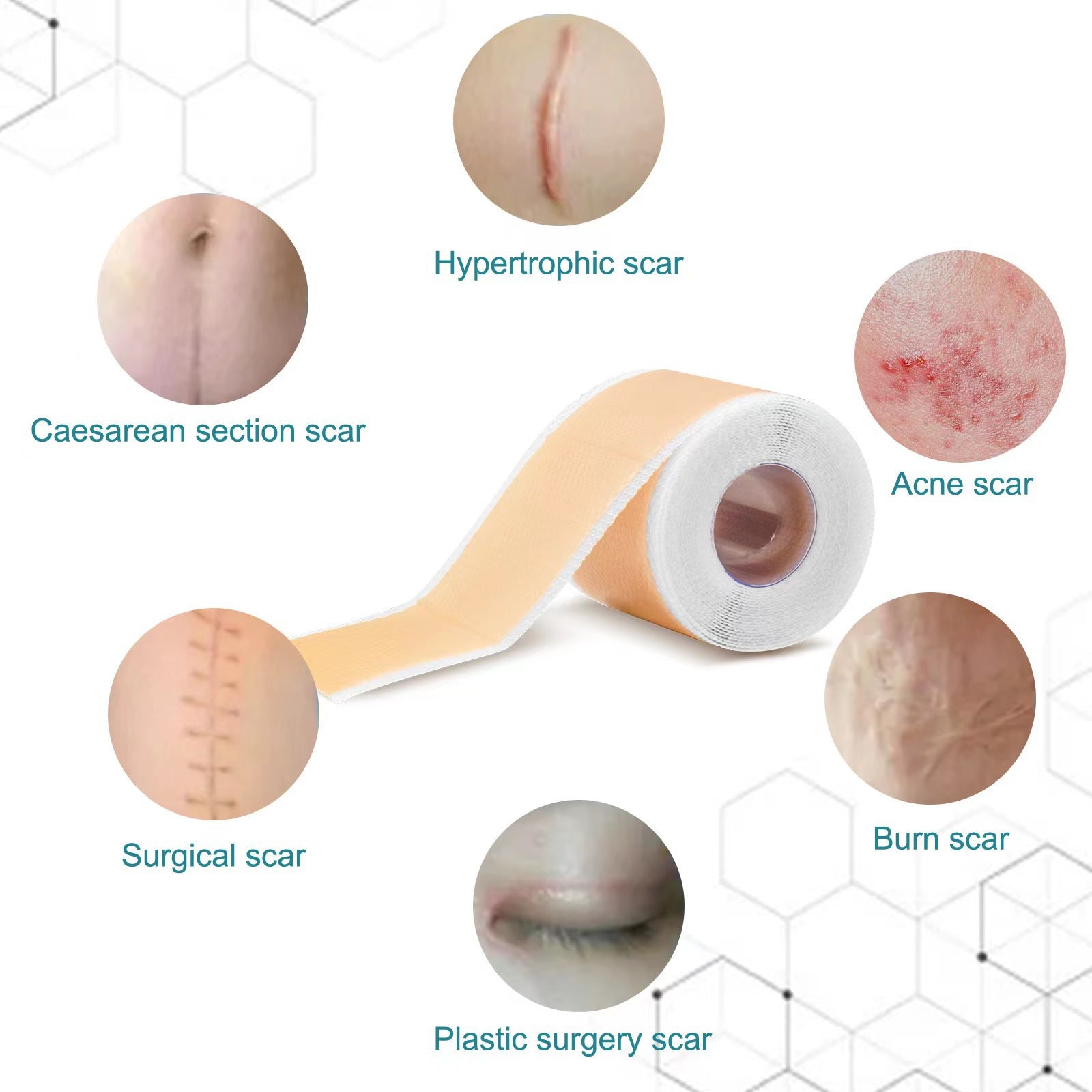 Silicone Anti-Scar Sheets for Healing - LessBarriers